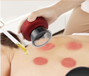 Ventouse de Massage électrique anti-cellulite pour corps rechargeable USB